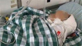 大陸,男嬰,頭骨,磚塊,腦死。(圖/翻攝自微博)