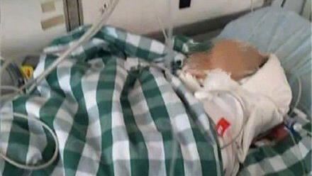男嬰被磚塊砸中　頭骨凹陷爆血腦死