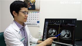 大千綜合醫院,肝膽腸胃科,林裕鈞,肝癌,電燒療法,電燒