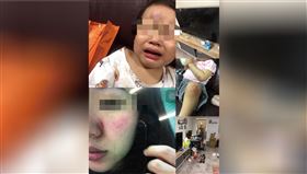 家暴,高雄,酒後,住院