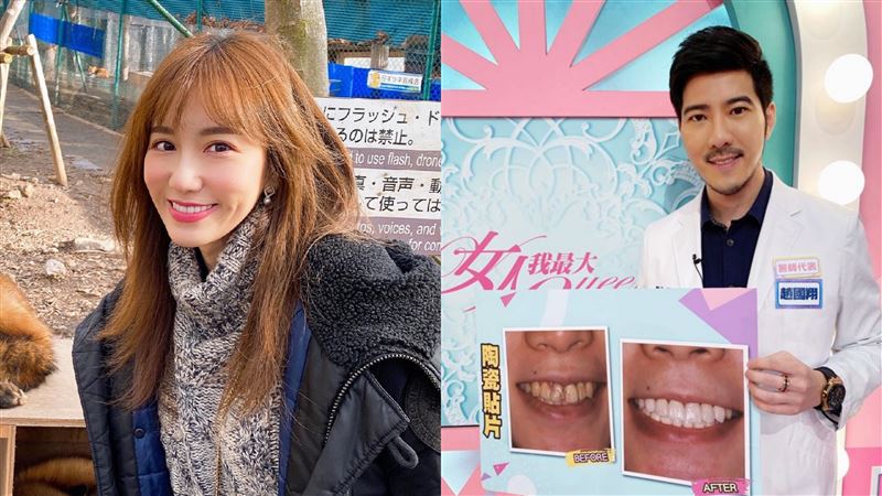 秘戀最帥牙醫師　女星曝認定對方關鍵