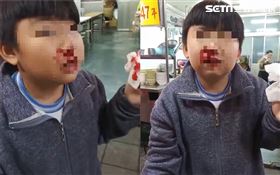 男童被甩耳光,小六生　圖／王欣儀議員提供
