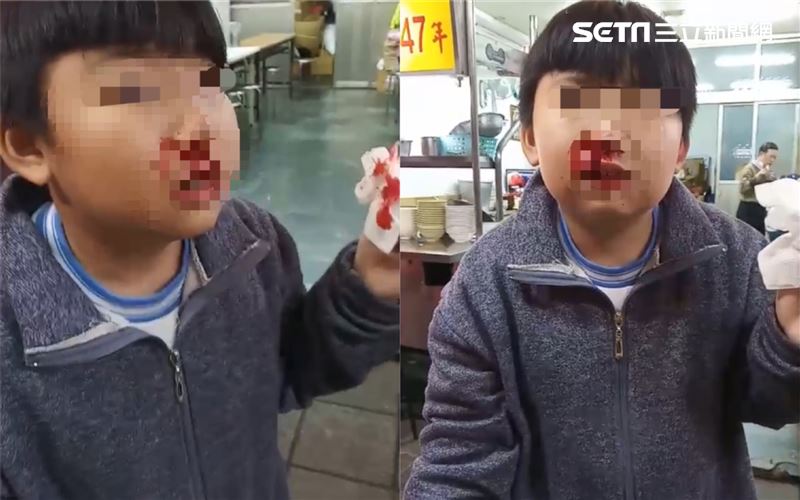 北市國小男童吐口水　遭導師痛打耳光
