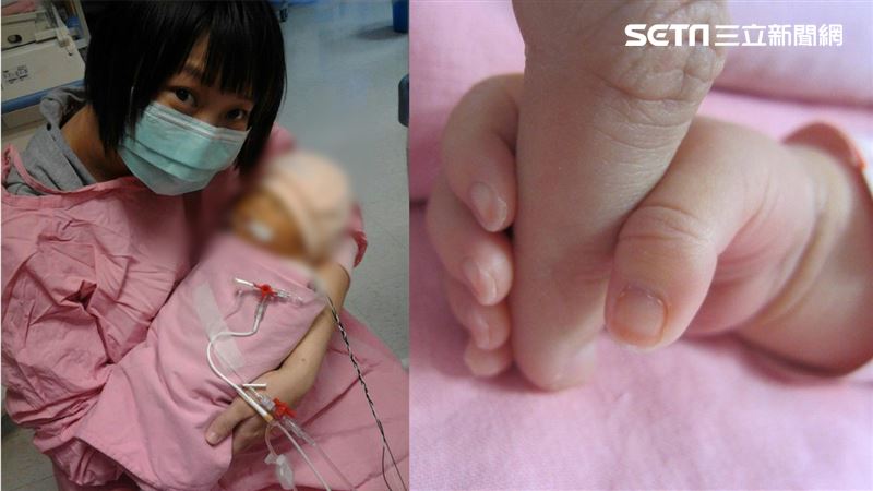 女嬰早產肺破裂　小手緊握血崩母想活