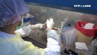 輕症不二採防疫破口？醫憂親友恐感染