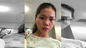  越南,澳洲,排華,騎士,毆打,潑酒（圖／翻攝自vietnamnews）