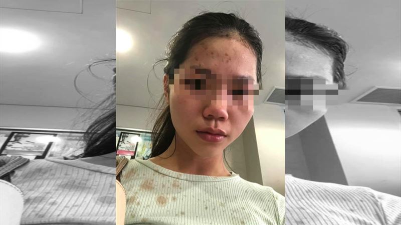 澳洲火車上戴口罩　越女遭人痛毆丟瓶