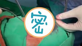 台中,黑道,大哥,插眼,眼球,眼珠,筷子