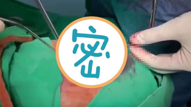 慎入！筷子插腦8公分　竟還看得見？