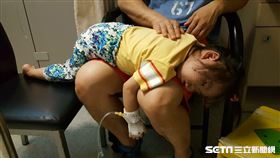 黴漿菌肺炎感染（許雅惠提供）