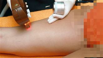 男技師趁除毛性侵！台中男崩潰：吃掉我了