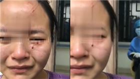 患者,咬傷,不配合,治療,廣州