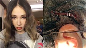 蕭亞軒,Elva,受傷,頭部,重創,傷口