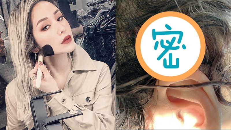 蕭亞軒驚曝頭部遭重擊？留四公分傷疤