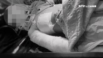 男童校園墜5樓重傷　家屬控遭推下樓