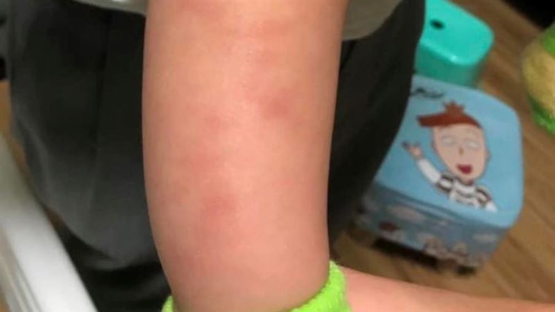 男嬰送托全身傷！托育員遭爆竟是累犯