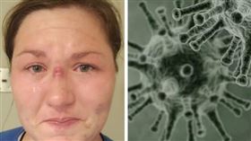 美國護士（臉書）