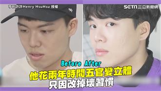 花兩年時間五官變立體　因改掉這習慣