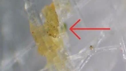 戴過的口罩多毒？放大2千倍細菌在動