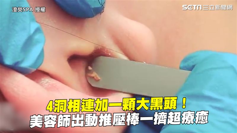 4洞相連+大黑頭　推壓棒一擠超療癒