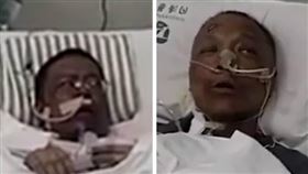 染武肺竟「全身發黑」（截圖微博影片）