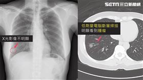 羅東博愛醫院胸腔內科提供