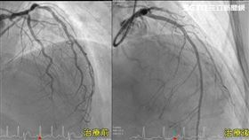亞洲大學附屬醫院,心臟內科,王志偉,低密度膽固醇,家族性高膽固醇血症,心臟衰竭
圖／亞太醫院提供