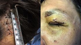 潮境公園,狼狗,未繫繩,攻擊,受傷,主人