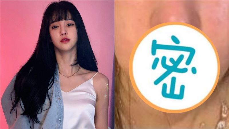 花十億整形被打　女模臉「完全歪掉」