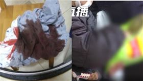 中國男童愛吃肉，半夜屁股大噴血。竟然是息肉掉了。（圖／翻攝自微博）