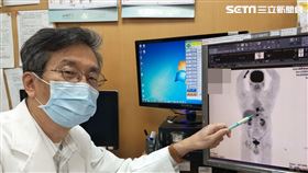 放射治療,童綜合醫院,放射腫瘤科,葉啟源,標靶真光刀,食道癌,打嗝
圖／童綜合醫院提供