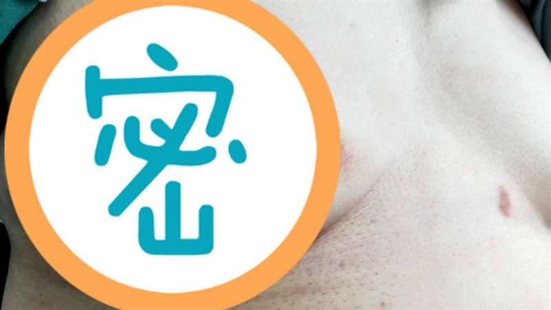 秋冬傳染病四起「這疾病」發病比生產還痛