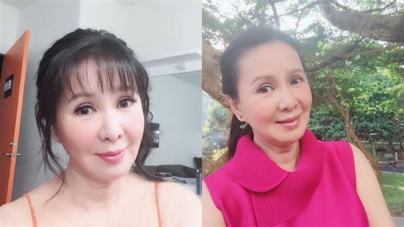 林美照健康出事　腸20腫瘤1原位癌