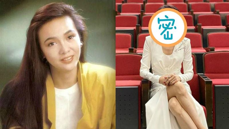 62歲鄭裕玲「臉歪了」疑似換膚過度