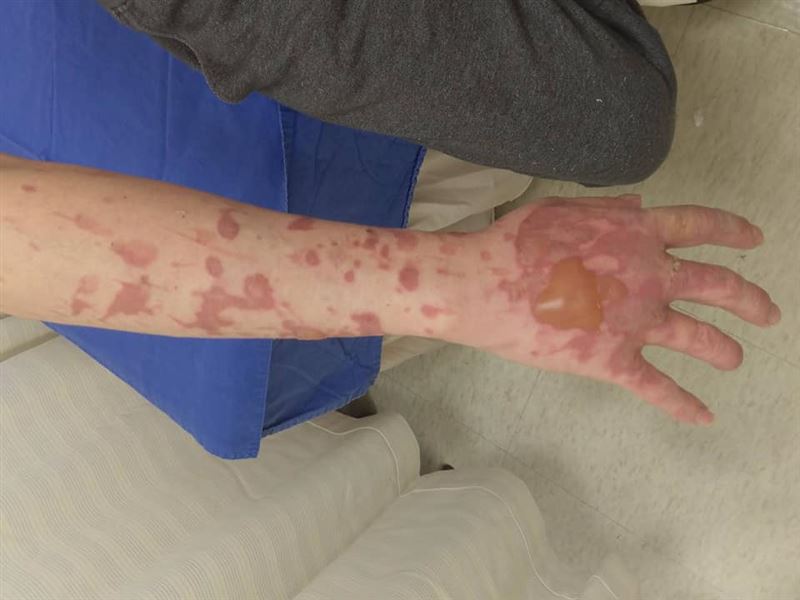 工作不合翻臉爭吵　她朝男同事潑熱油