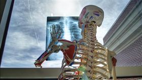 肺部Ｘ光（Pixabay）