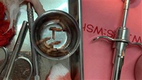 7旬翁嘴唇超腫　醫竟夾出「12條肥蛆」（圖／翻攝自Thanatnon Rong Assava臉書）