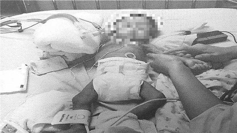 3月大女嬰餓到皮包骨　檢方起訴生母