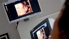 （圖／Pixabay）產檢,超音波,懷孕