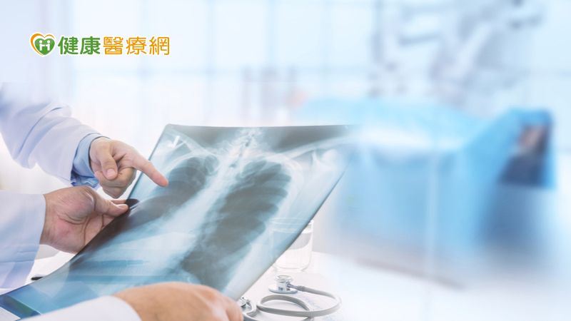 晚期肺癌標靶藥接續治療七旬婦成抗癌模範生 名家 三立新聞網setn Com
