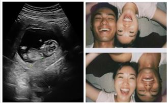 曝超音波照！楊祐寧親洩「當爸心聲」