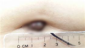 （圖／翻攝自鄭丞傑醫師臉書）醫師好辣,月經,衛生棉,子宮內膜異位,鄭丞傑