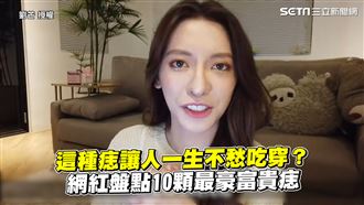 一生不愁吃穿痣　網紅盤點十顆富貴痣