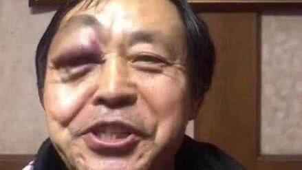 30秒被業餘KO!太極大師曾稱:可以把對手打到鼻子骨折| 國際| 三立新聞 ...