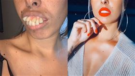 嫁牙醫前後差很大！暴牙女秀驚人變化
巴西,網紅,抖音,暴牙,牙醫,整型
翻攝自TIKTOK Jaquelinealarcao