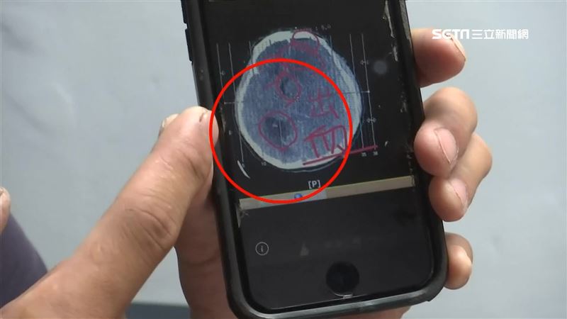 入監10天死亡　高大成曝三致命原因