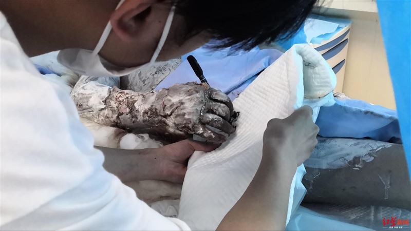 炸雞店爆炸　男焦黑顫抖寫下：救媽…