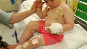 ▲英國被蛇咬的小男孩。（圖／翻攝自推特）