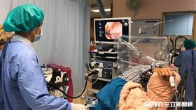 大腸鏡（門諾醫院提供）