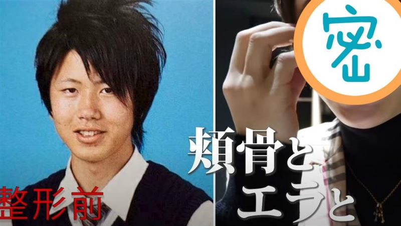 牛郎臉99%動過刀　光鼻子就4百萬